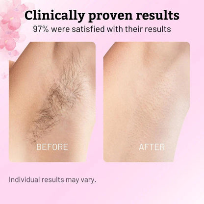 100% Natural Cyperus Rotundus Skin Serum
